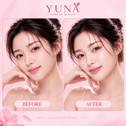 Illustrative before and after presentation for YUNA skincare